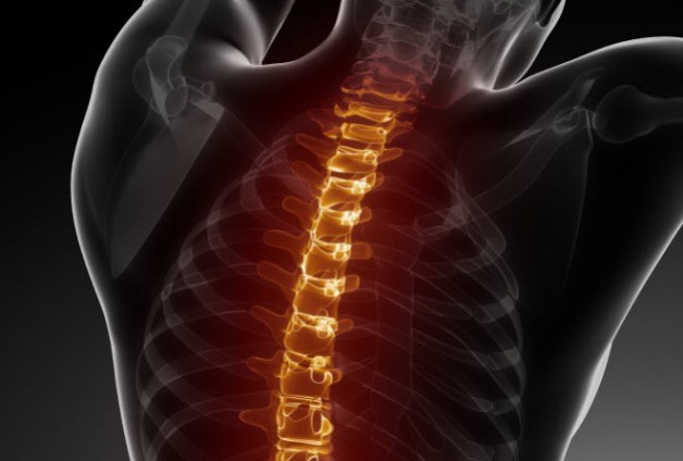 Back Surgery: Too Many, Too Costly and Too Ineffective